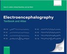 Electroencephalography